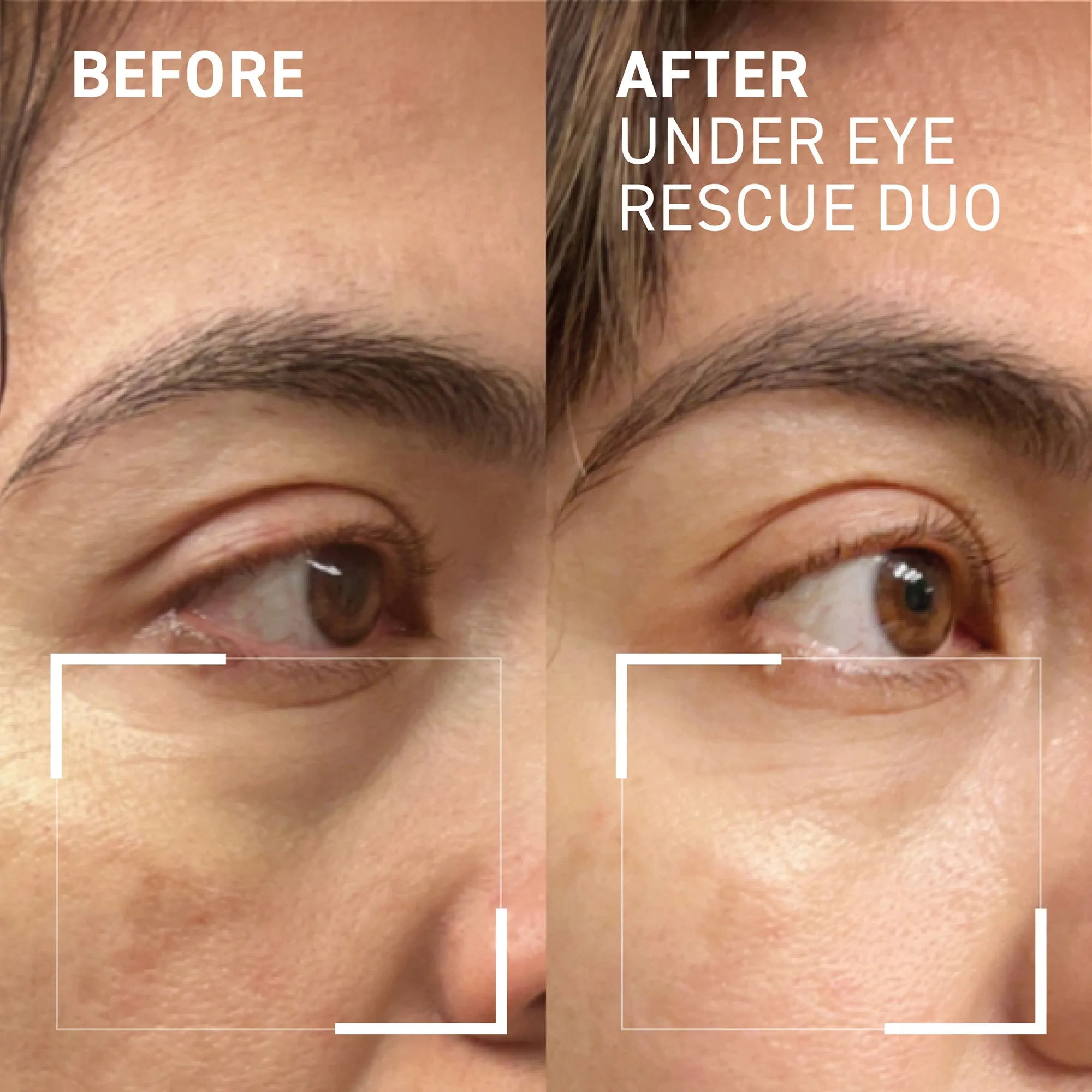 UNDER EYE RESCUE DUO